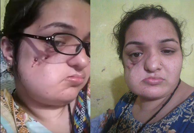 Aapka_abid's tweet photo. @SushmaSwaraj @beenasarwar @rushrk1 @InUthdotcom @k_satyarthi @Malala aplog se guzarish hai ki @FaizaTanveer8 ki madad Kare plz #Helpfaiza https://t.co/gl67TZob55
