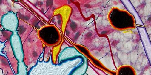 Listen to this CAPcast: How Art Can Inspire and Empower Both Patients and #Pathologists:  capatholo.gy/2hnkyDF