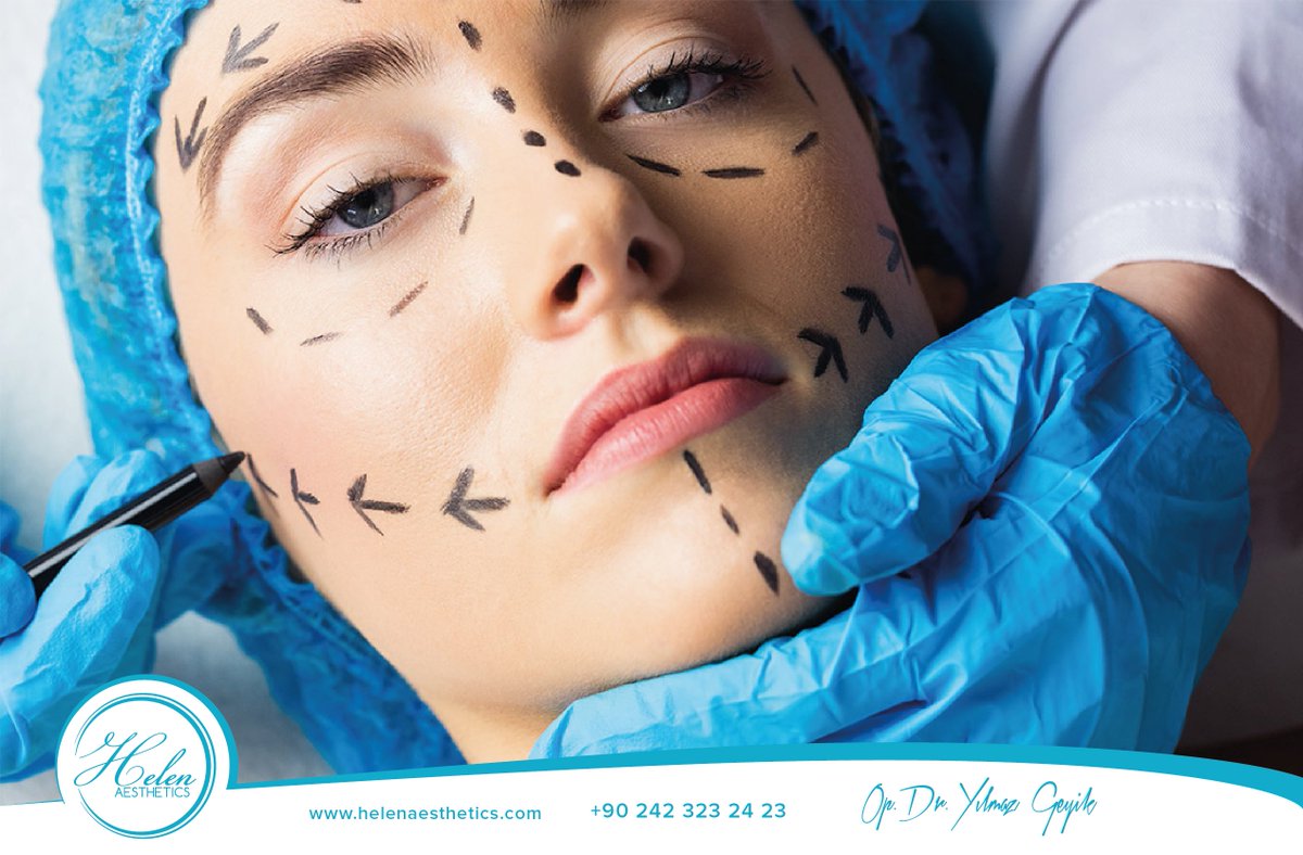 Yüz kemiklerinde kırıklar görülmesi durumunda genel anestezi ile operasyon yapılarak kırıklar normal anatomik durumuna getirilir.