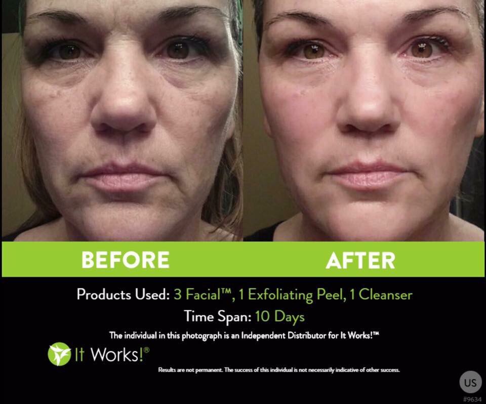 abby_itworks25's tweet photo. THIS!!!! 6️⃣product testers spots open for 90day 📅challenge! 👀Who wants it 🙋🏼My price 💸Message 📲 me PLUS free peel😲

https://t.co/x0COUhU00o https://t.co/lG0dovsqAe