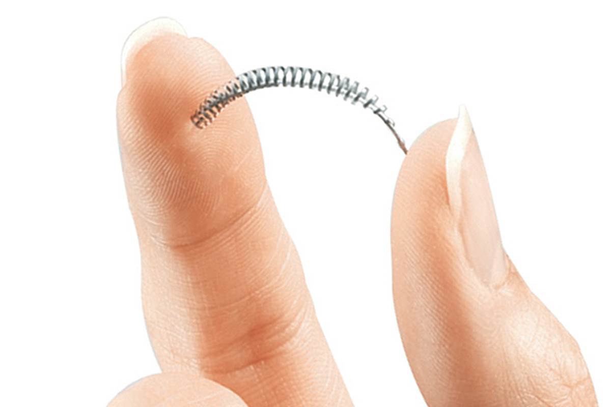 RisWorld's tweet photo. Le marquage CE de l’implant Essure est suspendu pour 3 mois https://t.co/qJZ6dVyuVY #essure #implant #medical #dm #ansm #france #europe https://t.co/Az7W2rCyXW