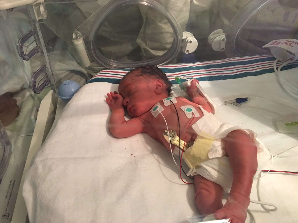 _Breyonnn's tweet photo. Baby boy has finally arrived 
Tristen Makhi Boston
August 4th, 2017
3lbs 8 oz https://t.co/WKKIM0EOZH