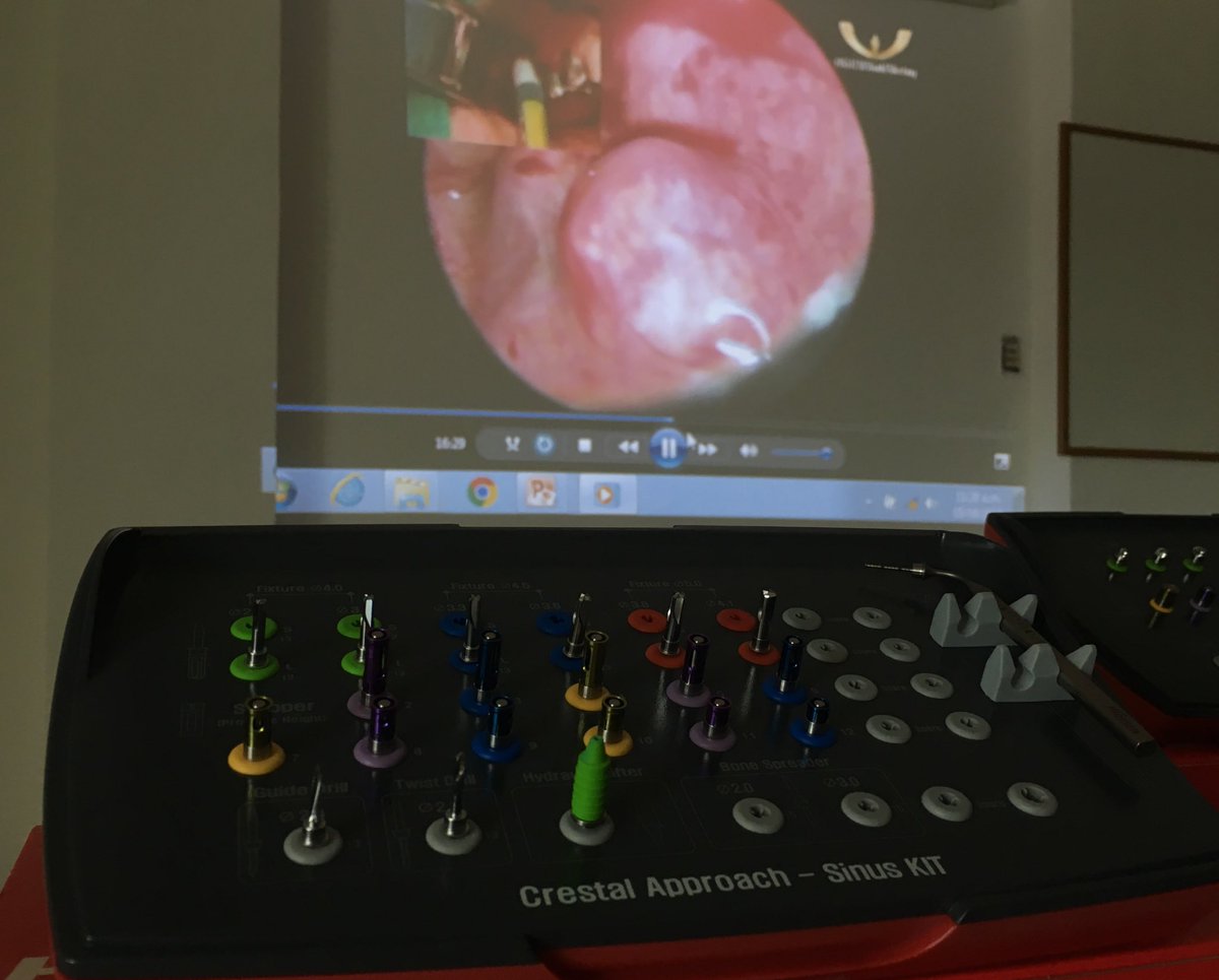 Ernesto_VITA's tweet photo. Learning about surgical techniques with HIOSSEN #dental #surgery #implants #hiossenimplants #aesthetic #dentistry @HiossenMx @Ernesto_VITA https://t.co/QbBoK0o14h
