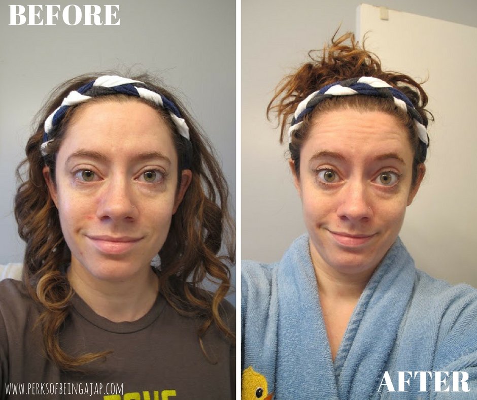 LaceyBean on Twitter "Check out my before and after from using Differin Gel! https//t.co