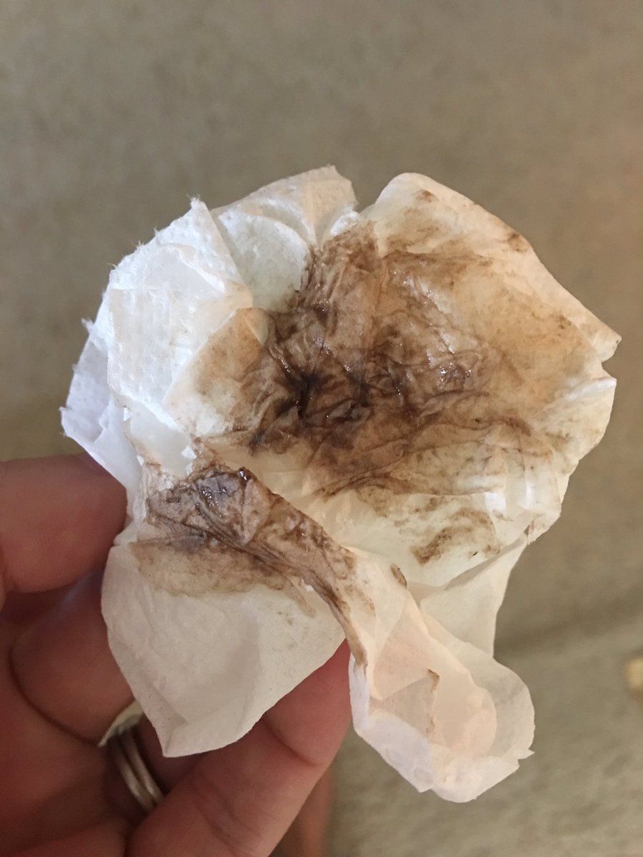 E2 9d 84 Ef B8 8fchannon Rose E2 9d 84 On Twitter So This Just Came Out Of My Vagina Pretty Sure I Might Be Dying So Love You Mom E2 9d 84 Ef B8 8fchannon Rose E2 9d 84 On Twitter So This Just Came Out Of My Vagina Pretty Sure I Might Be Dying So Love You Mom