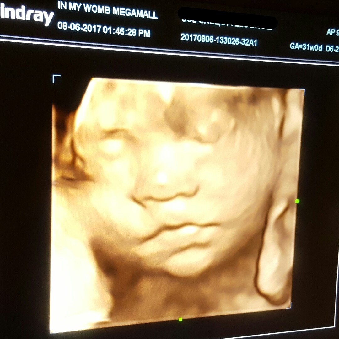 iamwriteousness's tweet photo. πππ Happy to see you, bebe!
.
#baby #babyph #bebe #motherph #motherhood #journeytomotherhood #mamahood #mamaph https://t.co/AQ3fEYDjkR