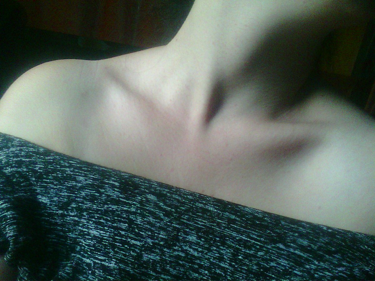 Heidi_Neri99's tweet photo. #ключица #фото #ключицы #девушка #эмо #гот #готика #гот #готесса #gotik #gothic #Emo #Emogirl #Emo2017 #emo_kid ##эмочка #Emogirl #EmoKid https://t.co/7sE8TVuECs