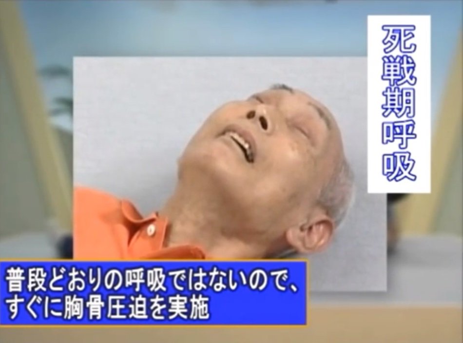 喘いだり しゃくりあげるような呼吸は 死戦期呼吸 しせんきこきゅう 心停止直前のサイン 迷わずａｅｄを Togetter