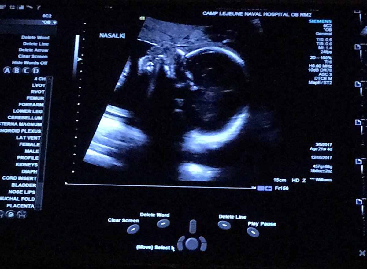 jordaantayy's tweet photo. #18weeksleft https://t.co/abqd3Xxotr