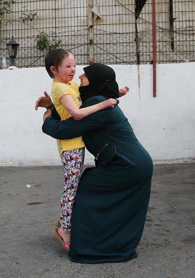 SyriaCharity's tweet photo. 8 mois de séparation... Les séquelles resteront gravés sur le visage de Hiba mais elle restera tjr la + belle créature sur terre pr sa mère https://t.co/c0ar19cgLp