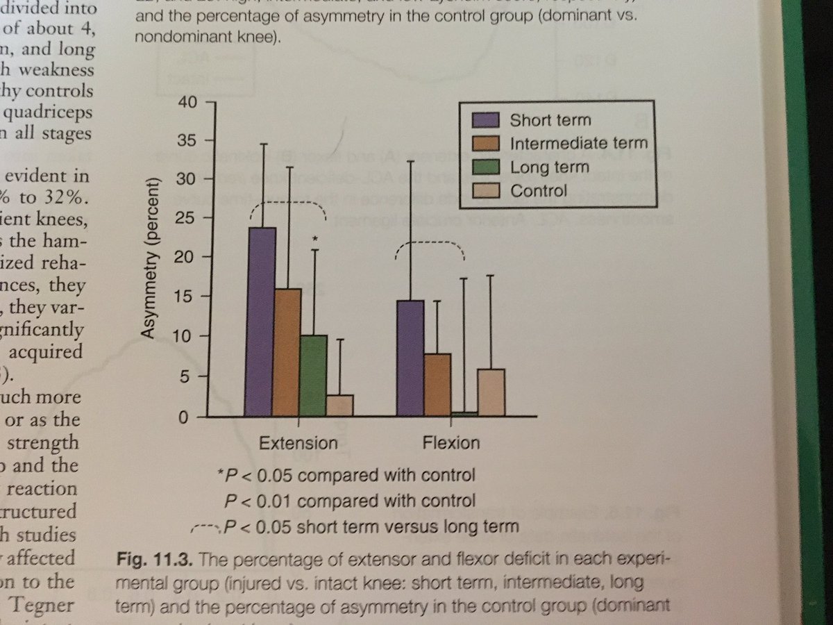Robptatcscs's tweet photo. Hamstring symmetry returns w/i one yr even without rehab in ACL def knees. Not same for quads. Persistent quad weakness is real. Get strong! https://t.co/q3STP5jqp3