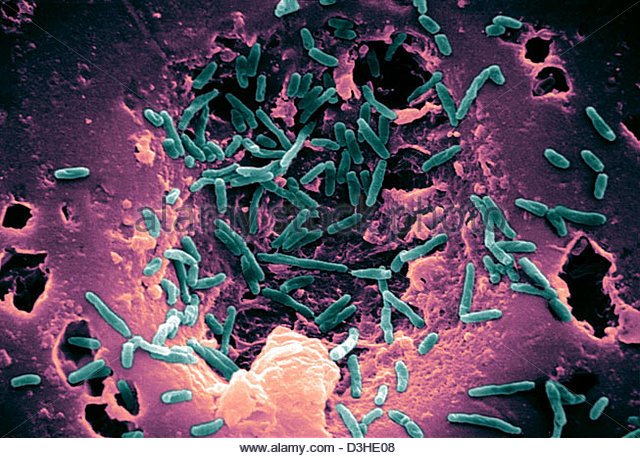 #Environmentalmycobacteria #tuberculosis #nontuberculousmycobacteria #livingwater #foodsources 
#environmicro@peerreviewedjournals.com