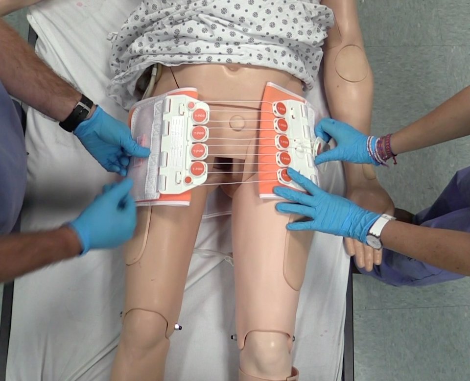Core_EM's tweet photo. New Procedure Video! Application of a Pelvic Binder https://t.co/8idZMyZARD | Key is placement over greater trochanters #FOAMed https://t.co/2VCwU9DUnA