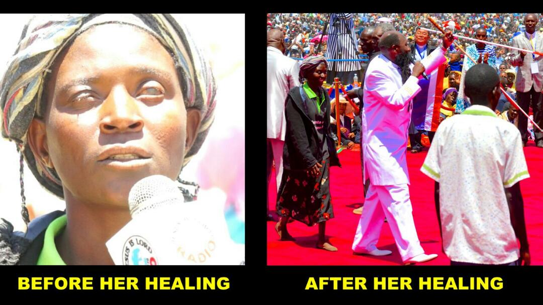 #MiraclesBreakOutInKenya BLIND EYES OPEN BY THE POWER OF THE LORD GOD THAT HE HAS INVESTED IN THE MIGHTIEST PROPHET.
