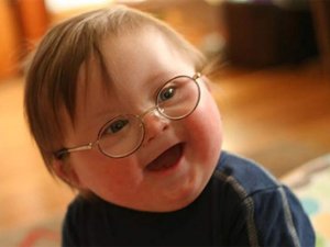 Down sendromu nedir?
yumurtaliekmek.com/sendromu-nedir/