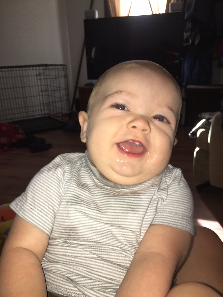 megancurboy's tweet photo. I've been on vacation for 12 days and my sister been sending me pics of my nephew and it melts my heart😭❤️ #2frontteeth https://t.co/xJjs4Xgd0M