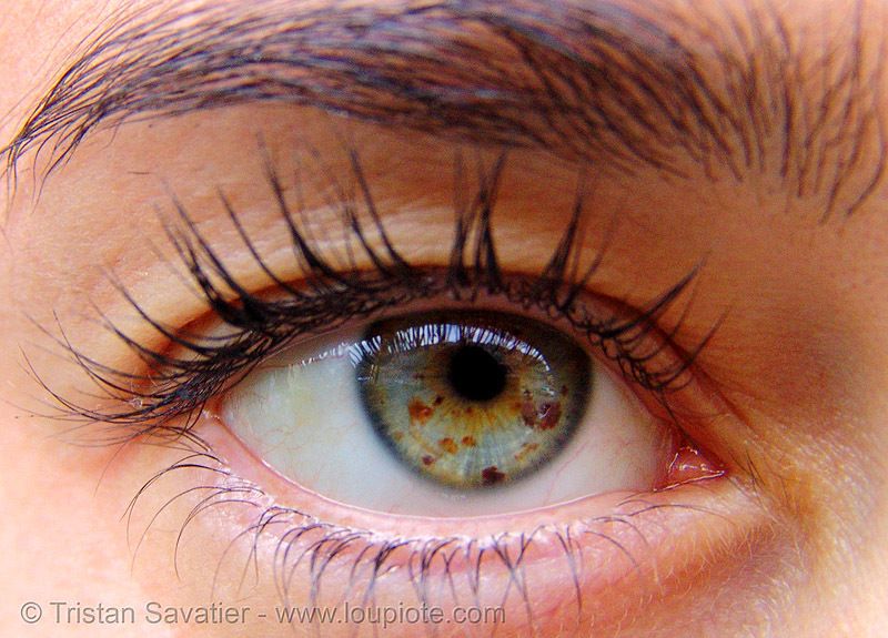 JerryMaidaMD's tweet photo. "What Eye Freckles Can Tell You About Your Health" via @goodhealth https://t.co/XDAhfUaPkI https://t.co/0xRh0JQmAf