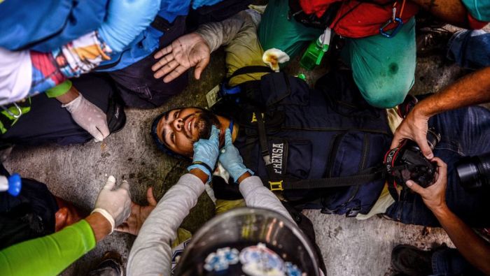 ONU: Hay violación sistemática a los derechos humanos en las protestas de Venezuela 
cnn.it/2uCOjTk