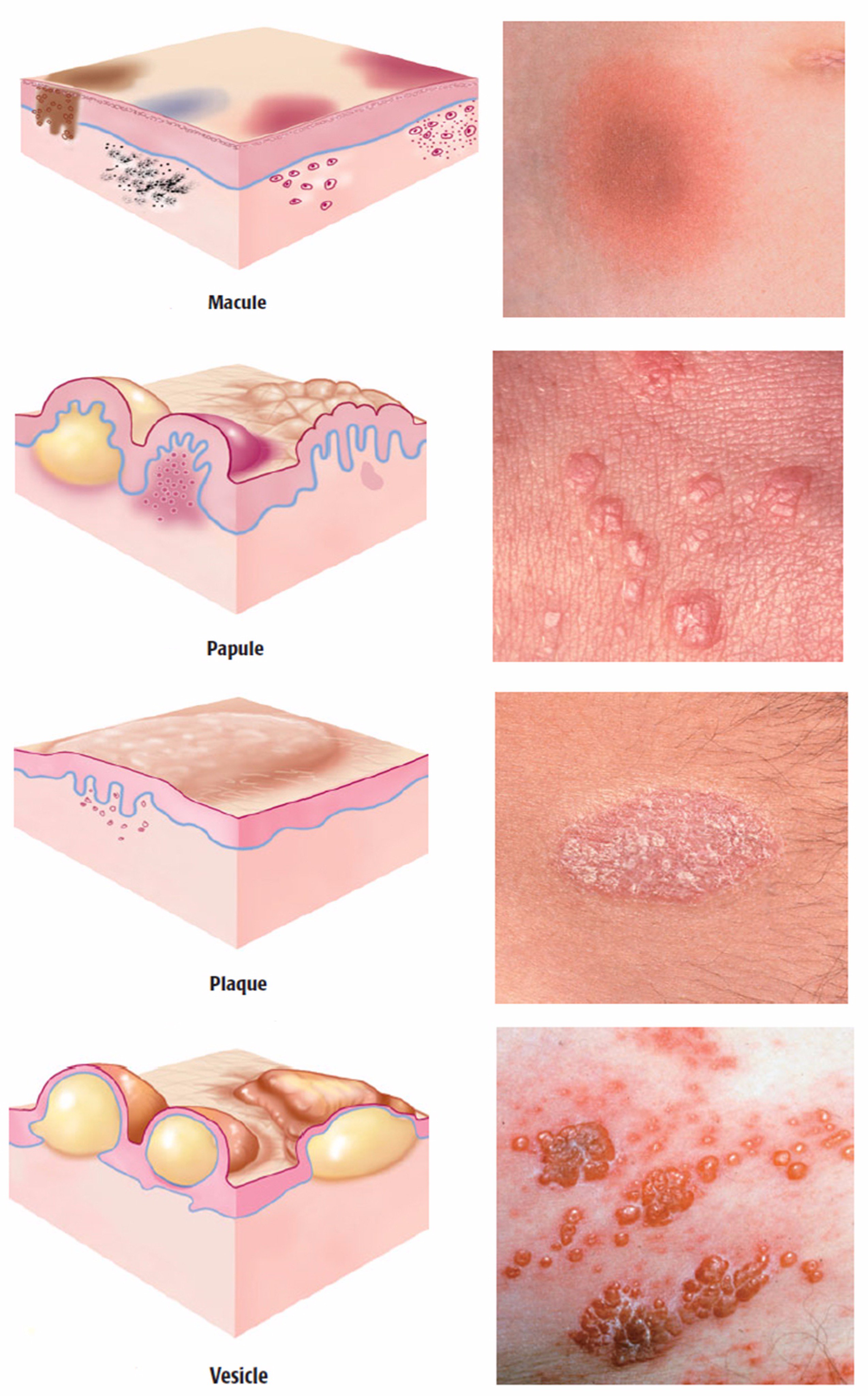 figure-from-hierarchical-classification-of-ten-skin-lesion-57-off