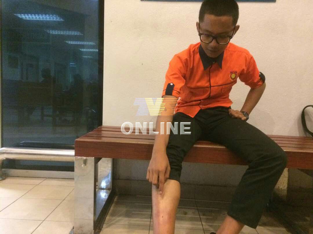 BuletinTV3's tweet photo. Ahmad Zikrill Azim Hasbullah, 16 mengalami kecederaan teruk dibelasah 20 pelajar senior di Kolej Vokasional Wakaf Tembesu, Terengganu https://t.co/WBFYEhdY2Q