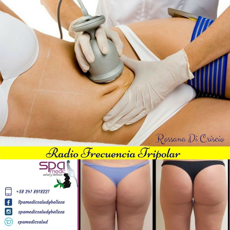 spamedicsalud's tweet photo. Radio Frecuencia Tripolar. Spa Medic salud y Belleza. C.C Unicenter Express, Local 14. Mañongo, Valencia. Visita: https://t.co/XxzpssP4kg https://t.co/Lji2l7Tt57