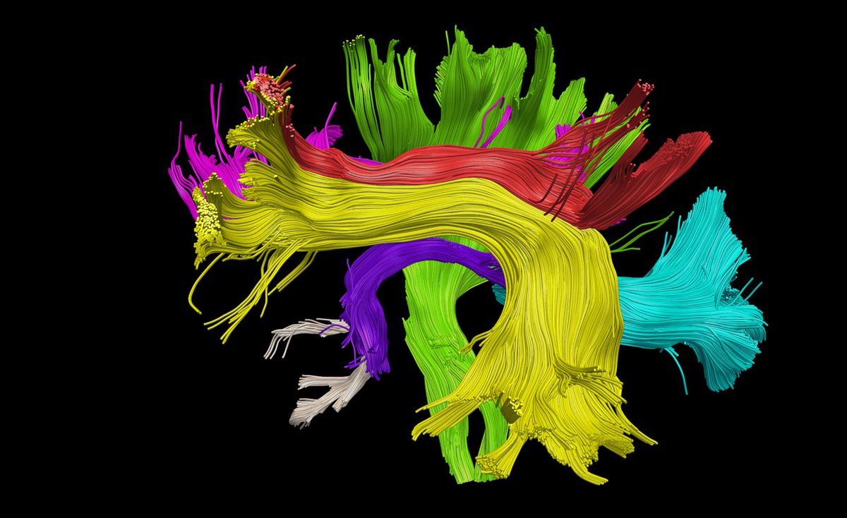 Emoties lijken weer de boventoon te voeren op ratio! 
blikopnieuws.nl/wetenschap/255…