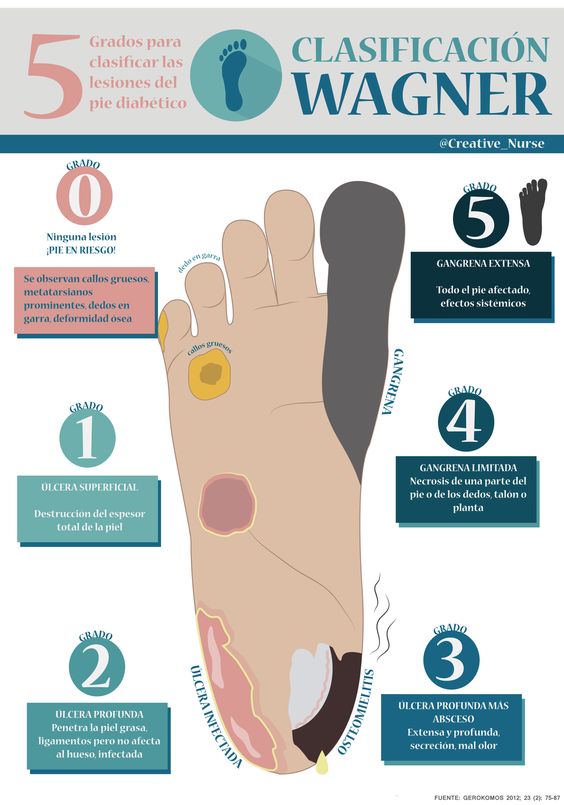 podocenter_'s tweet image. Durante los meses de #verano debemos extremar el cuidado de nuestros pies si somos #diabéticos. ow.ly/N94S30ei35z 
#Podocenter #clinic