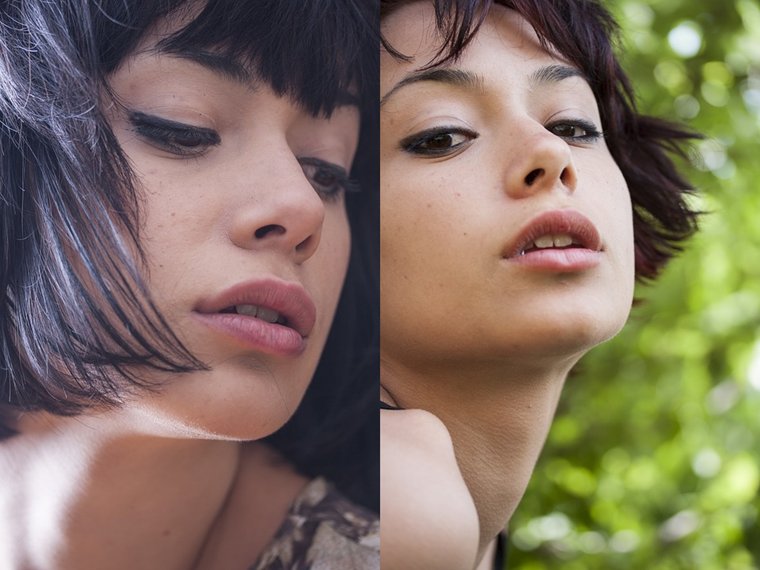 Bir operasyonla hem burun ameliyatı hem de burun estetiği 
medyamoda.com/bir-operasyonl…