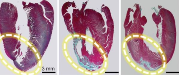 TheBHF's tweet photo. Researchers show how a particular protein can promote the growth of heart muscle in much the same way as exercise: https://t.co/rG0magNRQM https://t.co/tnQ2WJsZ7J