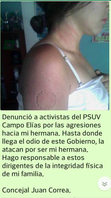 evelyncorrea_ec's tweet photo. El ataque hacia mi hermana lo dirigió Eloisa Albornoz alias Licha hoy #09Ago en #Mérida https://t.co/N4dnCu81h0