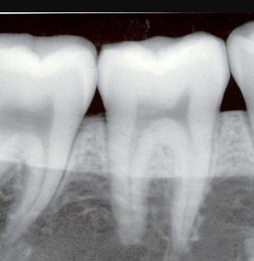 Did you know?
Teeth can tell our age, what we eat &amp; drink &amp; sometimes where on Earth we live #dentist #teeth #rva