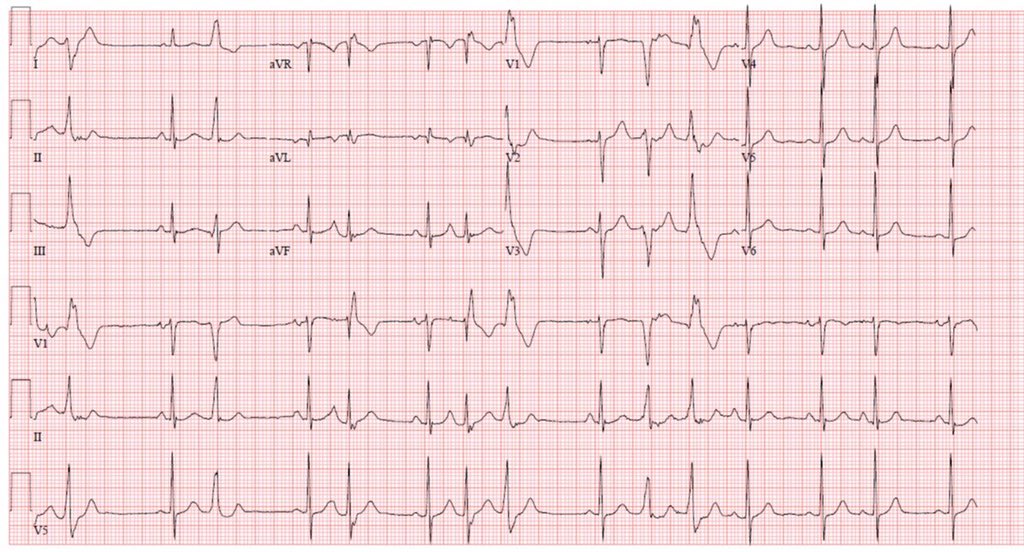 CCVUcardio (@ccvucardio) on Twitter photo 