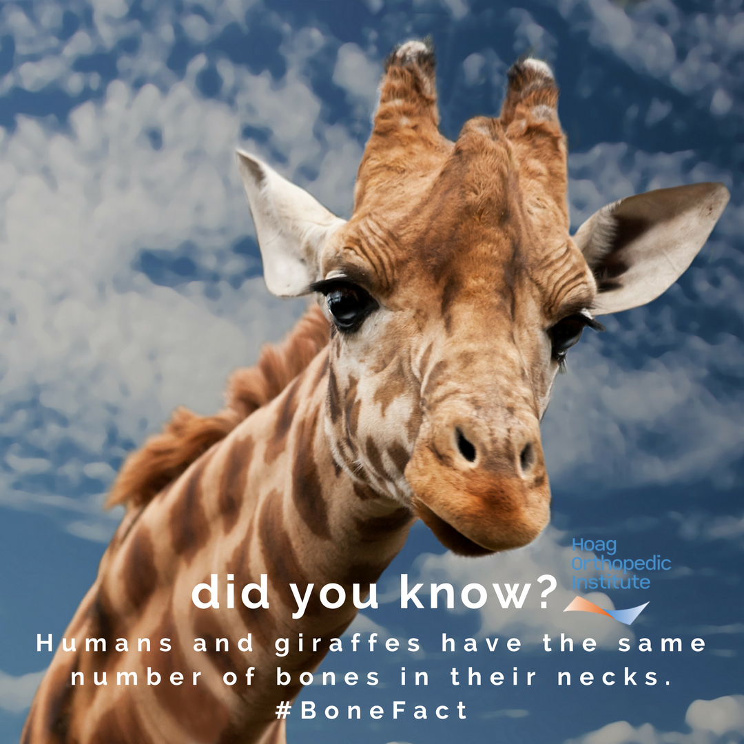HoagOrthopedic's tweet photo. Did you know? #BoneFact #Giraffes #HOI https://t.co/CJGpDyP4rc