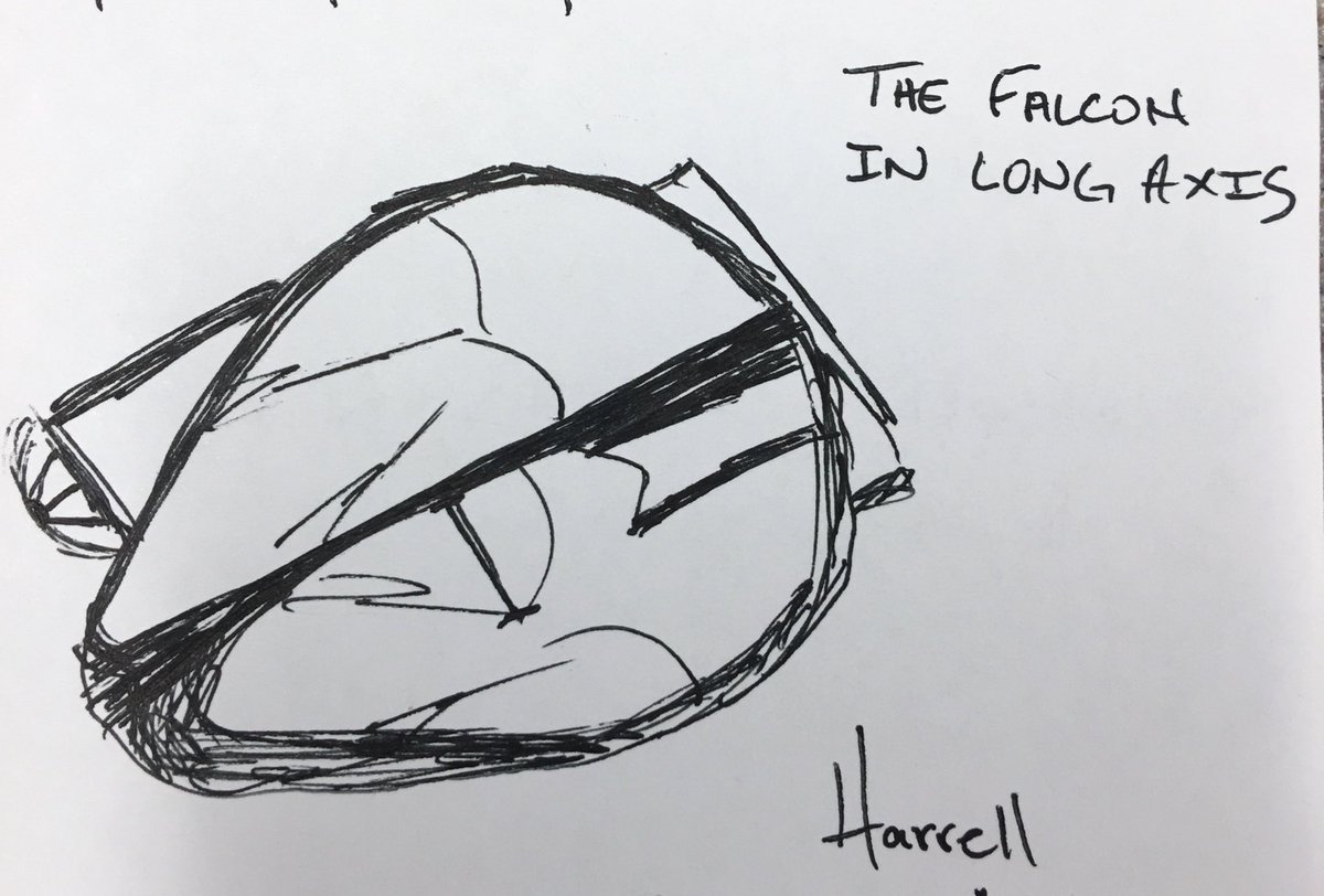 HenningsJacob's tweet image. @UltrasoundMD #milleniumfalcon #longaxis #pocus #hansolo #shootfirst #EPSS #FOAMus @CalHarrell