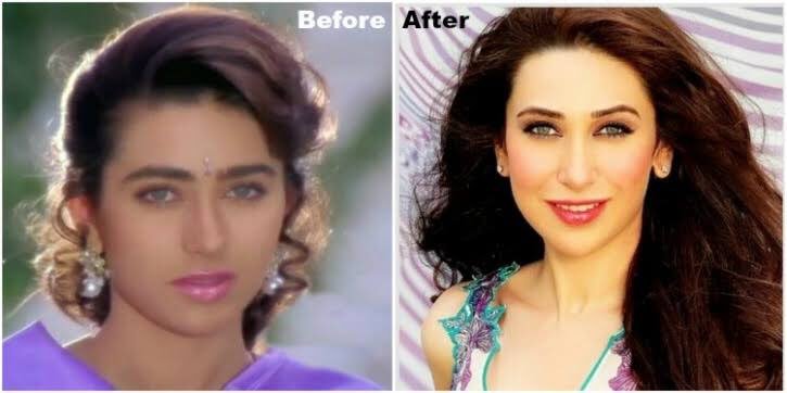olreadydotin's tweet photo. 4 Times Eyebrow Makeovers Royally Changed The Looks Of B-Town's Prettiest ! Which is your favorite transformation ? ๐
#IamOlready #tbt https://t.co/QHWjJ7Dkw6