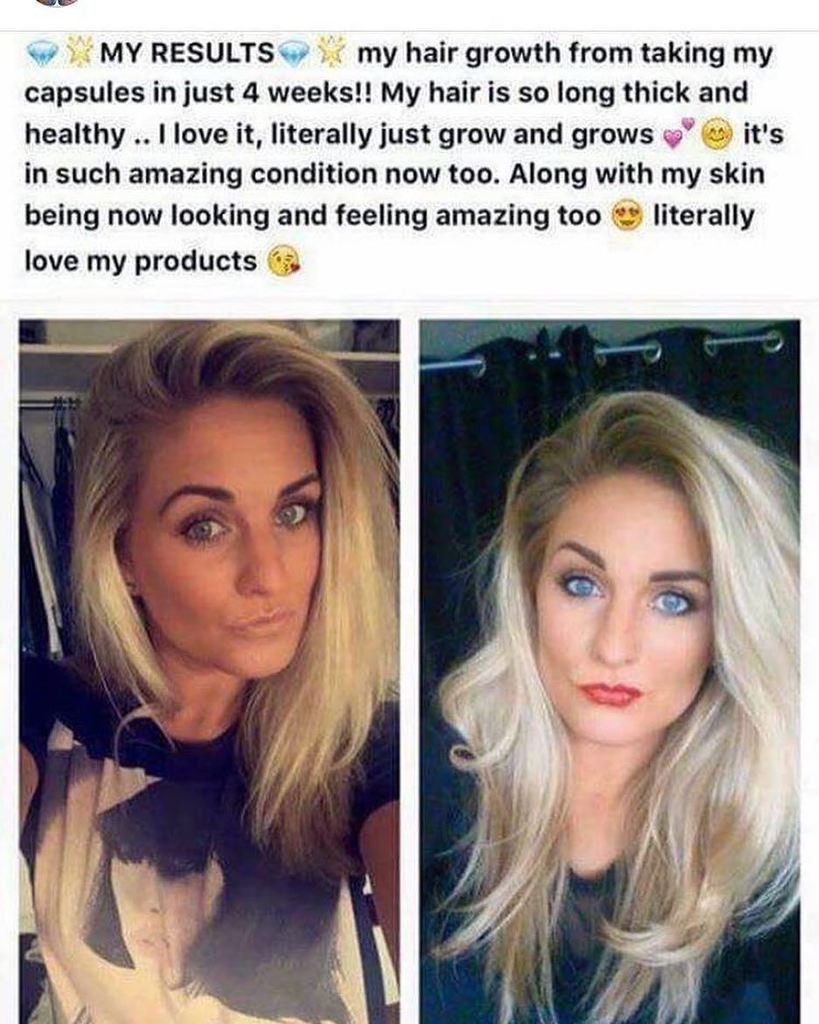 lifeconfidence_'s tweet photo. Just 4 weeks on our Berry capsules 😍😱 my favourite beauty product ❤👌💅 #thediamondfeeling #realresults https://t.co/JR291neznY