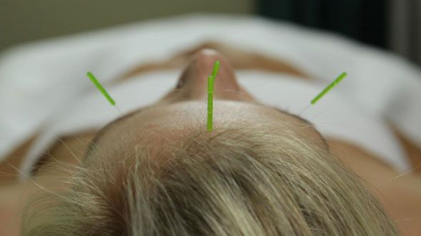 bethanntuttle's tweet photo. Attention athletes: Here’s why you need to add acupuncture to your wellness routine https://t.co/SM1BBlAjYJ https://t.co/TCvGvCfR57