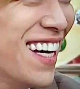 キスマイ歯担 清少納言 検索してもよくわかんないけど なんか千賀くん 前歯を変えたの 元々歯並びいいし自分で自慢て言ってたのになんで スイッチもキスマイレージもみれないから分からないよ T T それより右上の銀歯 虫歯 の方が気にな