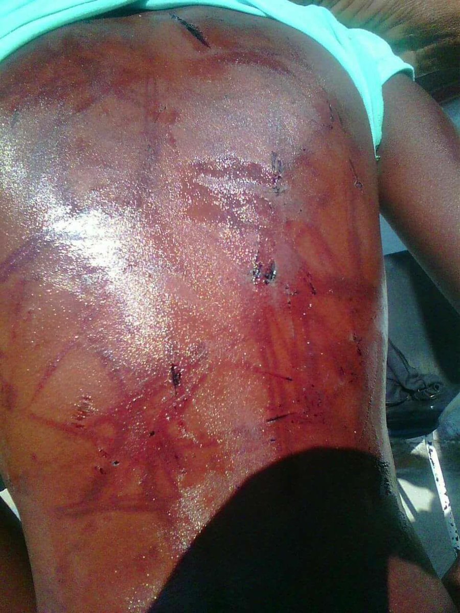 This child is allegedly being abused by her aunt in Matsulu Mpumalanga. #sabcnews