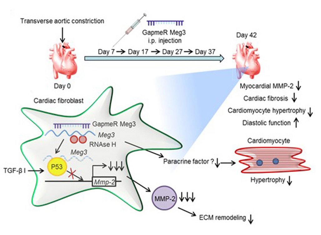 CircRes's tweet image. EDITOR PICK:  Inhibition of #Meg3 Prevents #CardiacRemodeling  ow.ly/ckCk30ez292  #noncodingRNA #rna