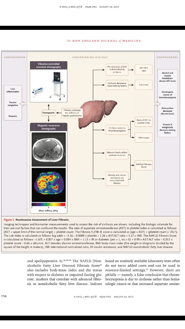 ebtapper's tweet photo. Liver biopsy 2.0 - 
 @AASLDPresident &amp; I highlight the progress/pitfalls in noninvasive liver evaluation. 

https://t.co/vcoBFTwlnx https://t.co/5cNIBNUh33