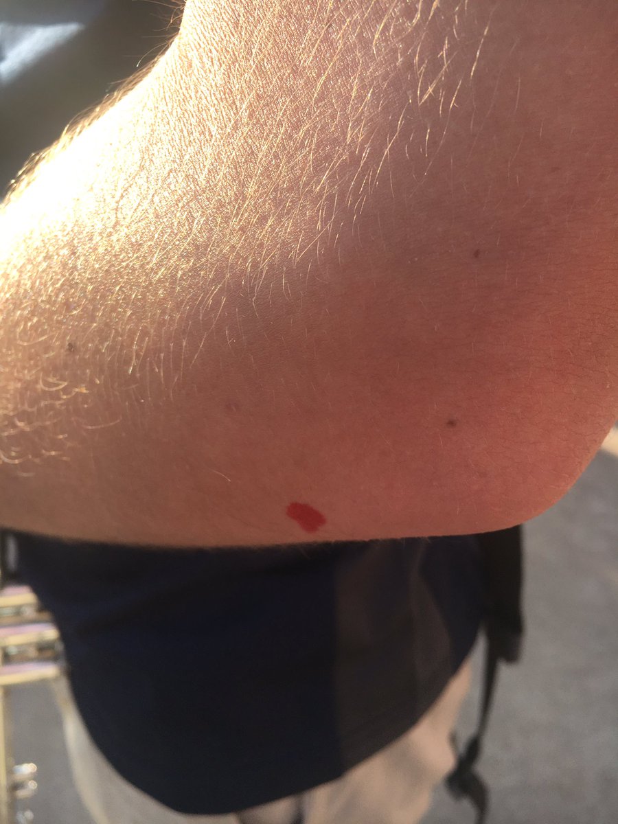Noah02130's tweet photo. Noah Jacobs is out @BandAssassins https://t.co/ydzWGrm2pa