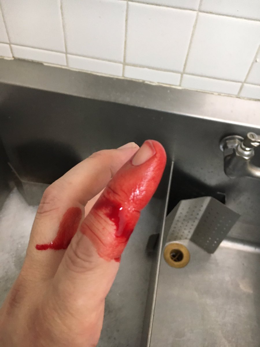 Kundun66's tweet photo. PSA:A broken 2x walled coffee glass is sharp..ALSO:Nice of my car to mock me, the prick. #NoStitchesNeeded #Cheflife #CleanitPatchitMoveon https://t.co/fPTzSBYJBz