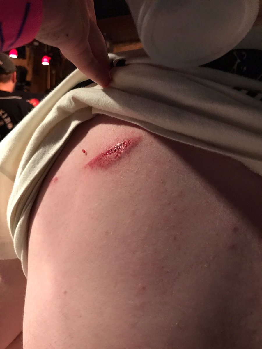 scottjameskelly's tweet photo. They'll tell you there's no work in being a vocalist. But sometimes blood gets spilt. https://t.co/cRnWcm5ZCD