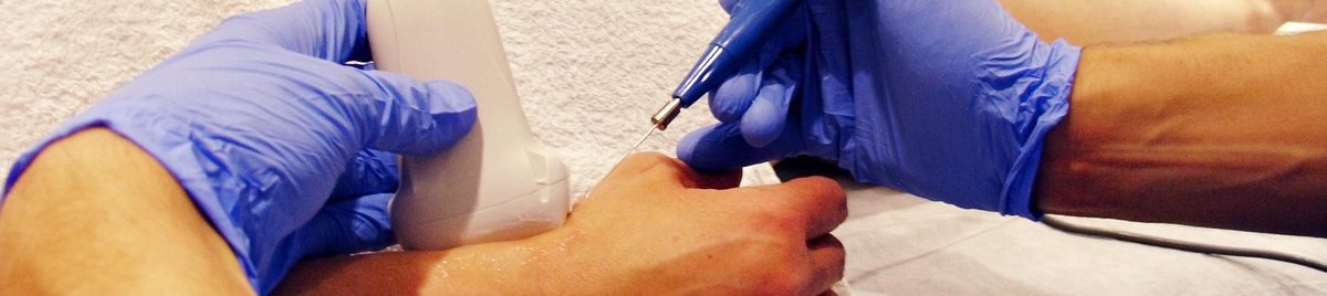 Abordaje de lesiones con electrólisis percutánea blgs.co/r9G-mt