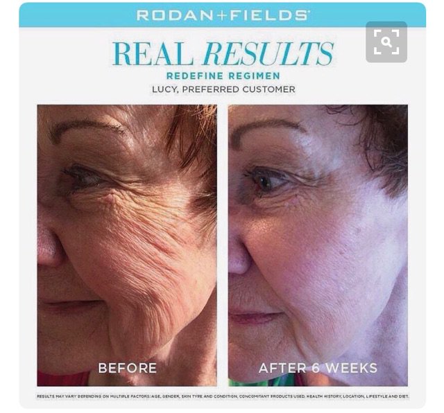 ashley_sharp91's tweet image. Winkles be gone!! Asks me how! #feelyoungagain #turnbacktheclock #rodanandfields #randf #redefine