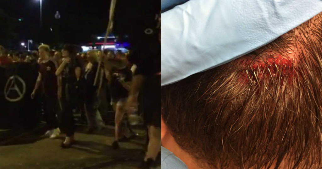 AntiFa left wing extremists attack Richmond photo journalist