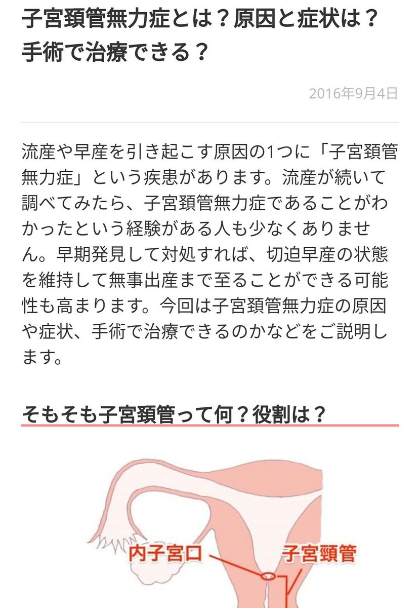 症状 子宮 症 頸管 無力 頸管無力症