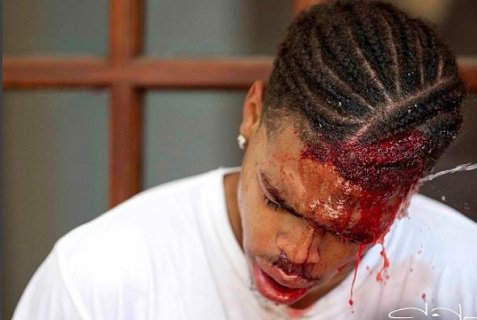 BlackAmericaWeb's tweet photo. Deandre Harris Was Beaten In Charlottesville Next To A Police Station https://t.co/yT8xk911S9 https://t.co/WAnM1iSmYE