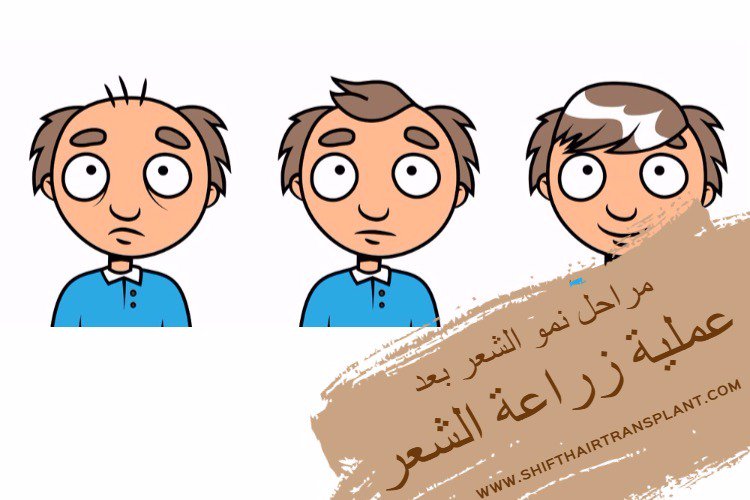 shifthair_ar's tweet photo. ماهي #مراحل_نمو_الشعر_بعد_الزراعة؟: https://t.co/nnQS4PLQT4

#زراعة_الشعر #زراعة_اللحية #زراعة_الشعر_للنساء #زراعة_الحواجب #زراعةالشعر https://t.co/qMIbvH0l2W